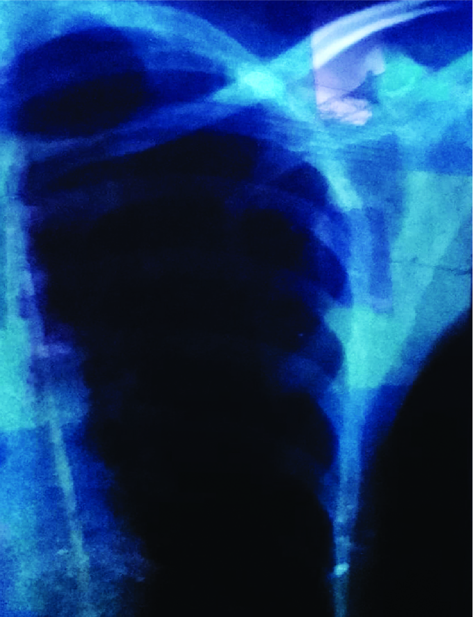 Memory Image