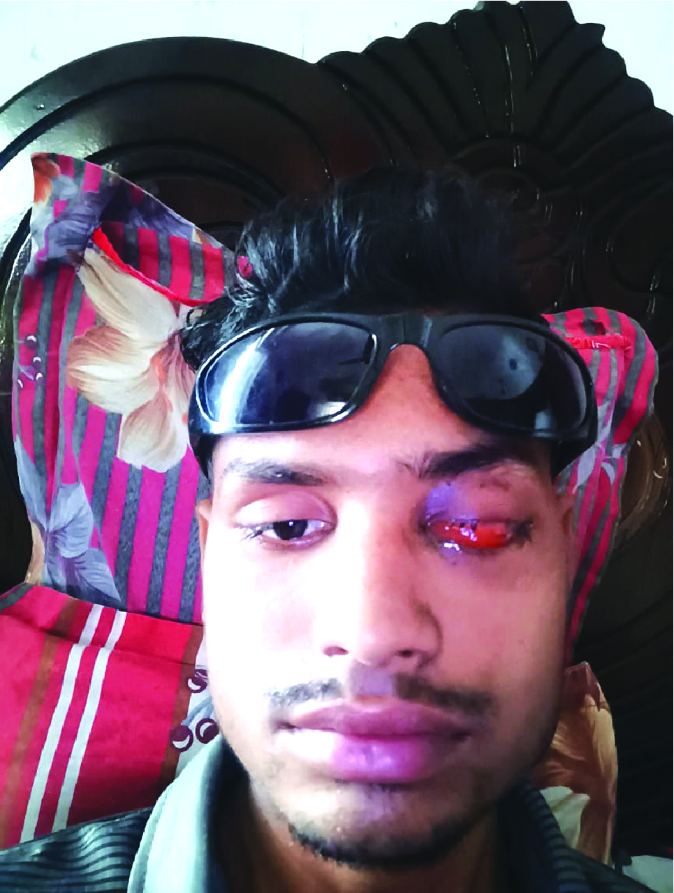 Memory Image
