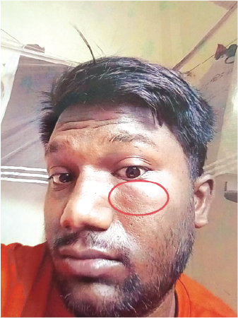 Memory Image
