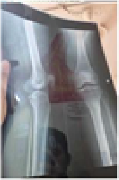 Memory Image