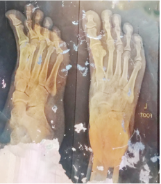 Memory Image